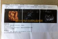 温州代怀代生机构温州附二医院试管婴儿成功率高不高‘怀孕看男女的图片大全’